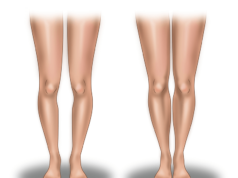 Особенности коррекции формы ног