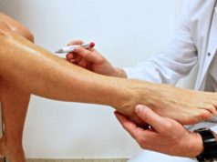 Эффективные способы лечения варикоза