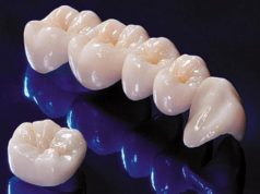 Что представляют собой циркониевые коронки?