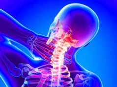 Причины шейного остеохондроза