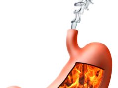 Изжога: причины и лечение. История из жизни