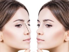Ринопластика носа : что необходимо знать о процедуре?