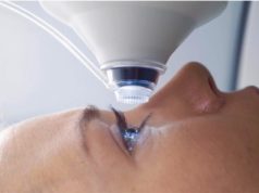 Этапы лазерной коррекции зрения