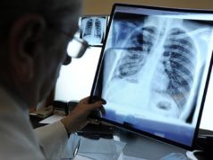 Врач предрек еще одну эпидемию после коронавируса