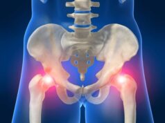 Способы лечения артроза тазобедренного сустава