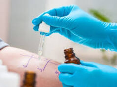 Услуги аллерголога-иммунолога – почувствуй жизнь без аллергии