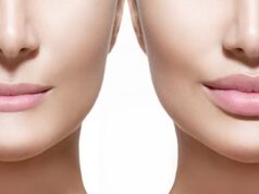 Как осуществляется процедура увеличения губ?