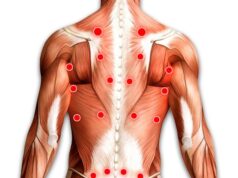 Как лечат миофасциальный синдром?