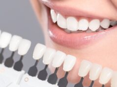Керамические виниры E-max: надёжный способ реставрации зубов