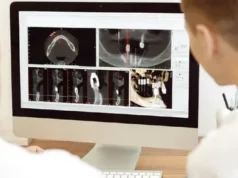 Корейская цифровая имплантационная система: достоинства