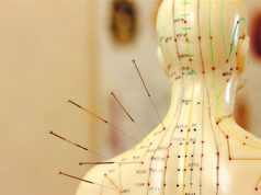 Какая польза от иглотерапии