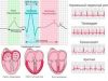 Специфика проведения ЭКГ