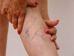 Причины появления тромбоза