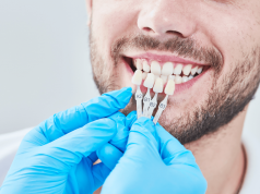 Советы по выбору хороших имплантов для зубов