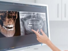 Как проводится компьютерная томография челюсти и зубов?
