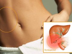 Симптомы воспаленного желчного пузыря