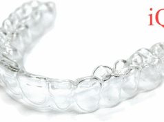 Какие ортодонтические проблемы способна решить установка элайнеров?