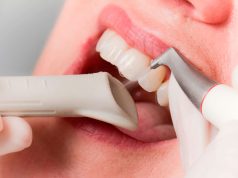 Чистка зубов Air Flow — плюсы и минусы процедуры