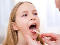 Ангина: основные симптомы и методы лечения