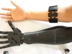 Выбор и освоение протеза руки