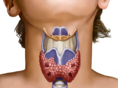 Что такое гипертиреоз