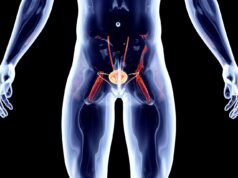 Первые признаки рака простаты