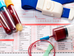 Какие анализы нужно сдавать регулярно?