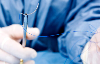 Как выбрать шовный хирургический материал?