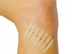 Как наносить полоски Steri?