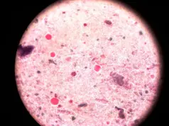 Бластоцитоз: Понимание этого загадочного процесса клеточной дифференцировки